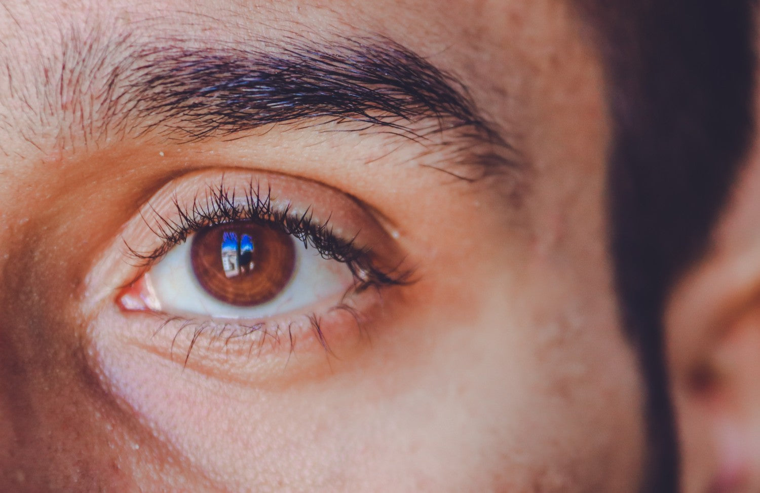 eyebrow dandruff home remedies