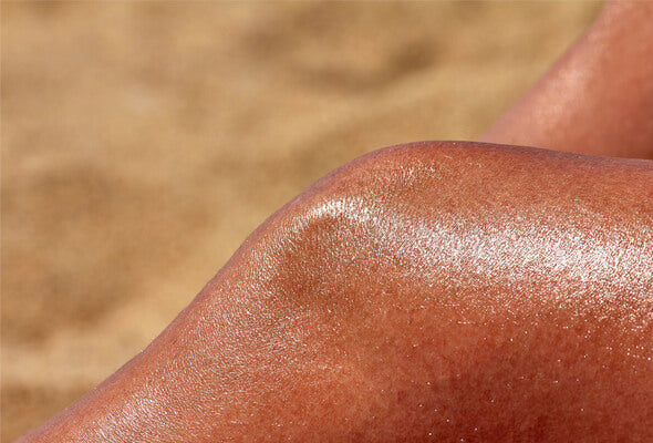 hot or cold shower for sunburn