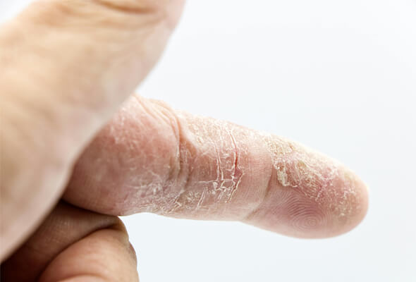 What Does Hard Water Do To Your Skin
