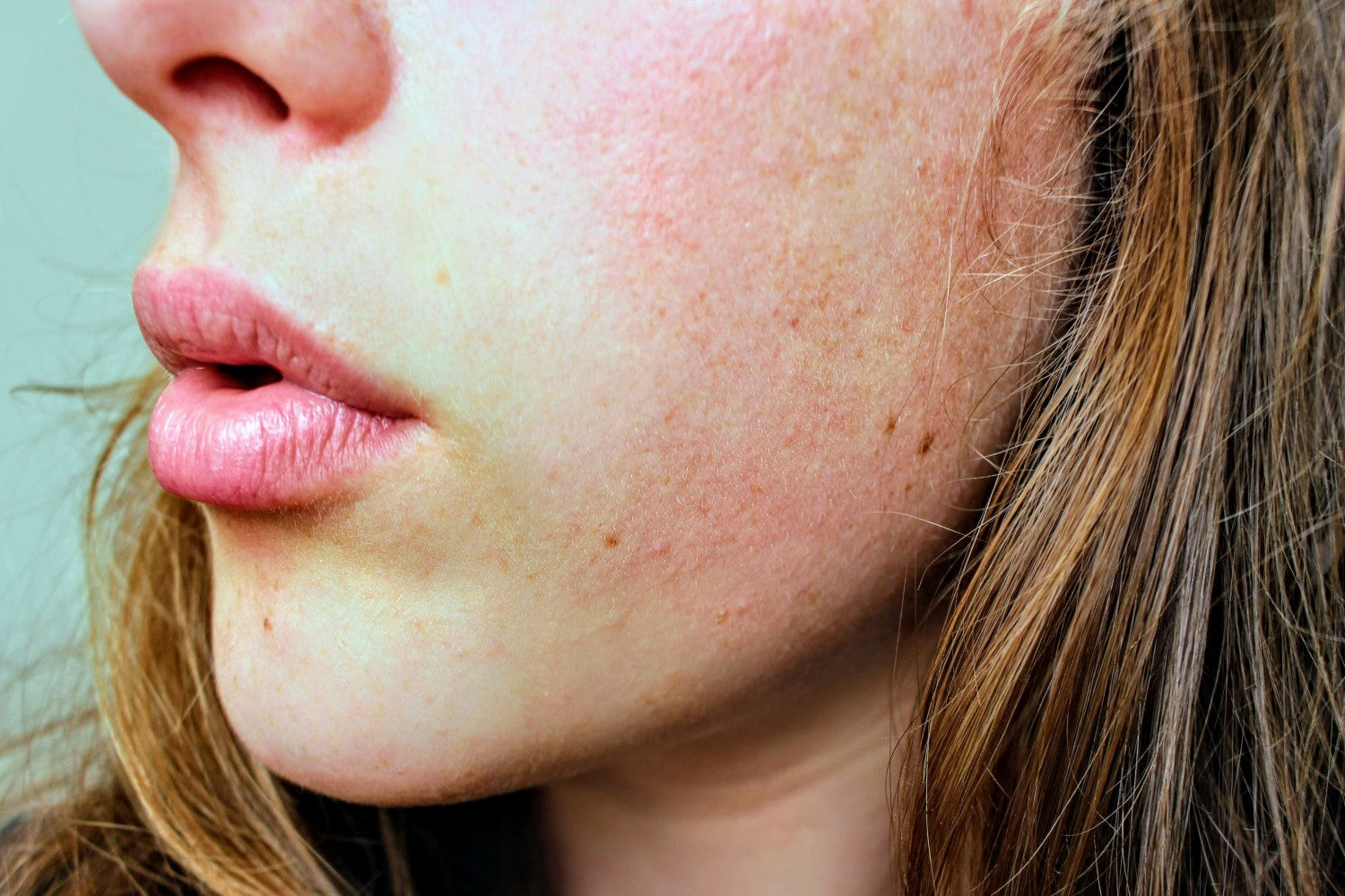 woman’s face with dry skin