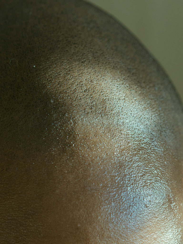 Close-up of bald head with visible texture